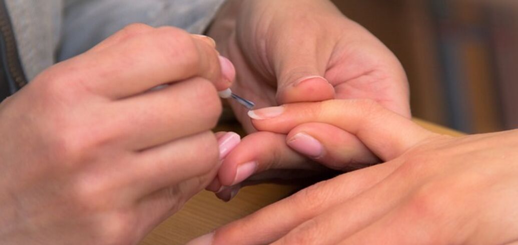 Порівняння бази та гелю