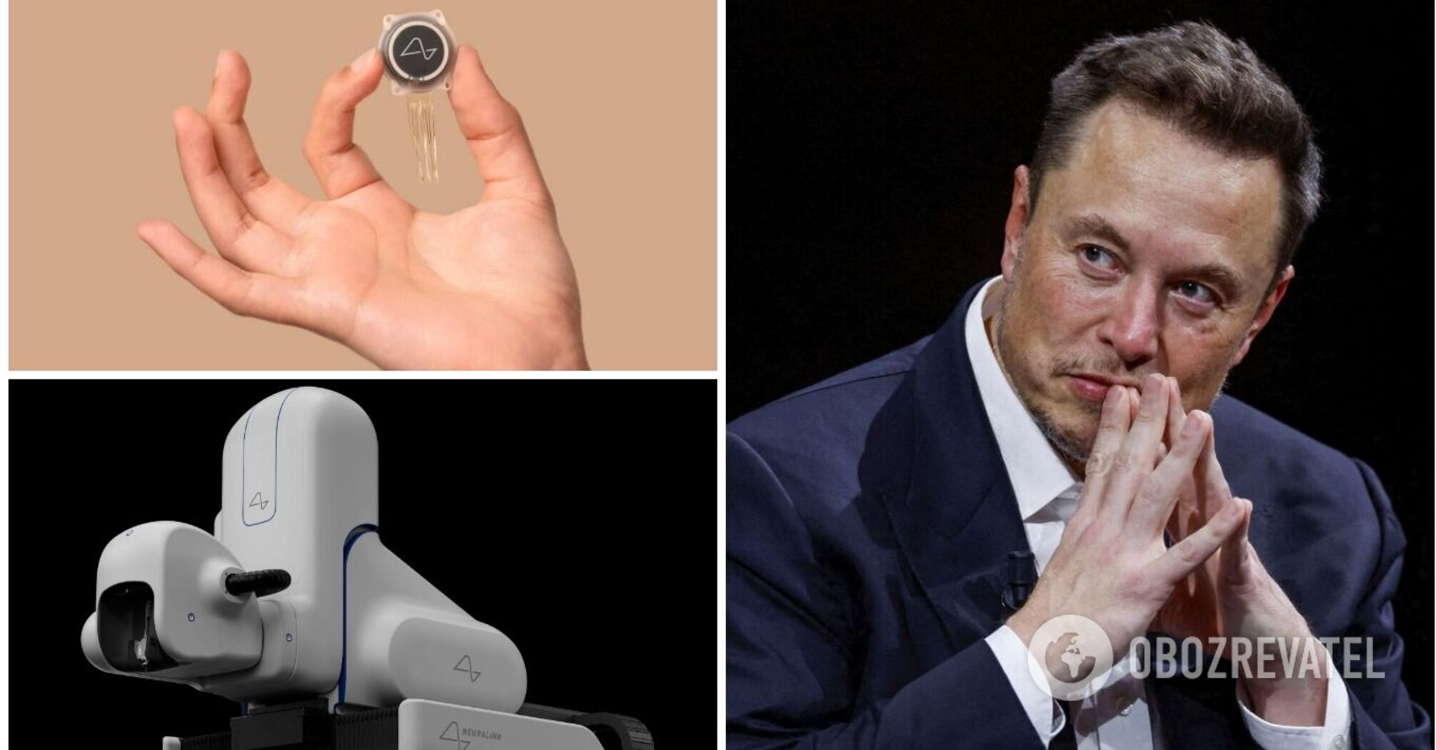 Neuralink chip implanted in human brain for the first time - what it ...