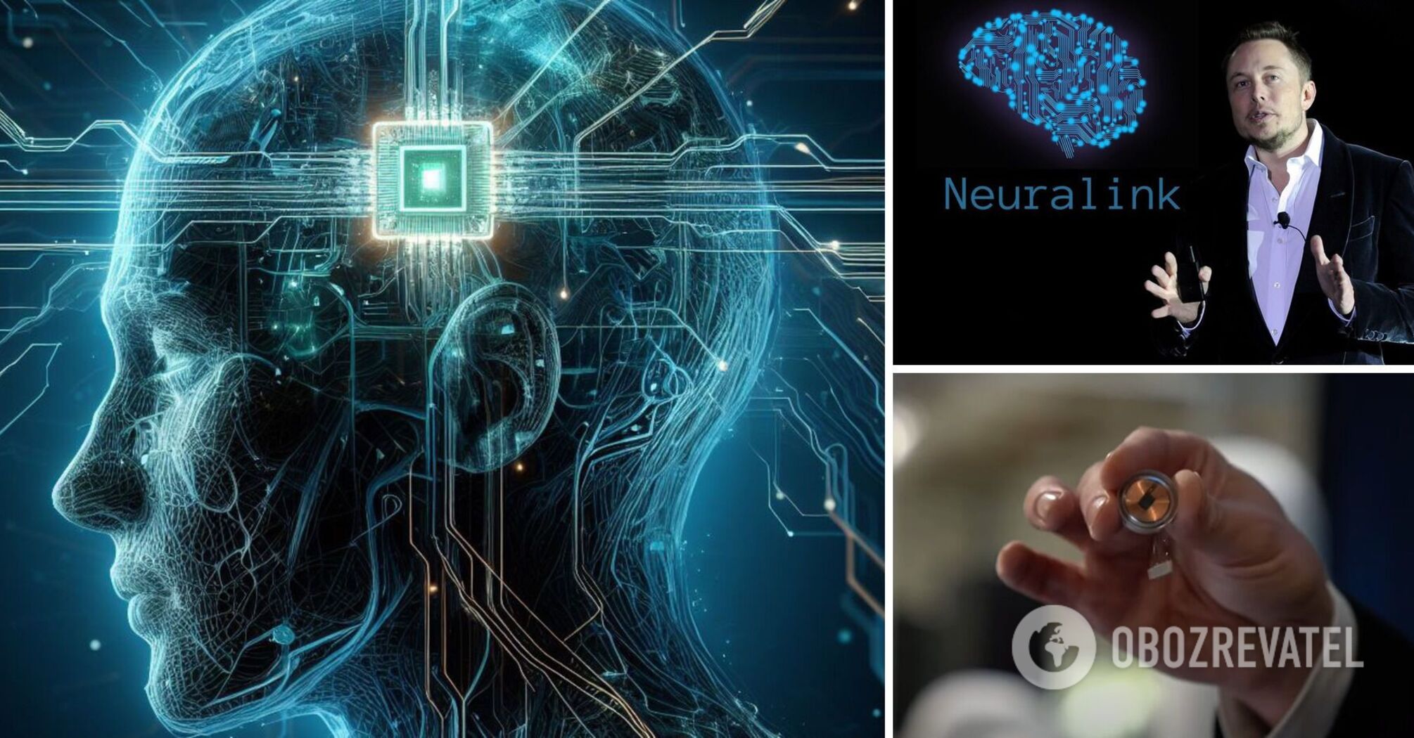 Musk has implanted a chip in the human brain for the first time: what will it do