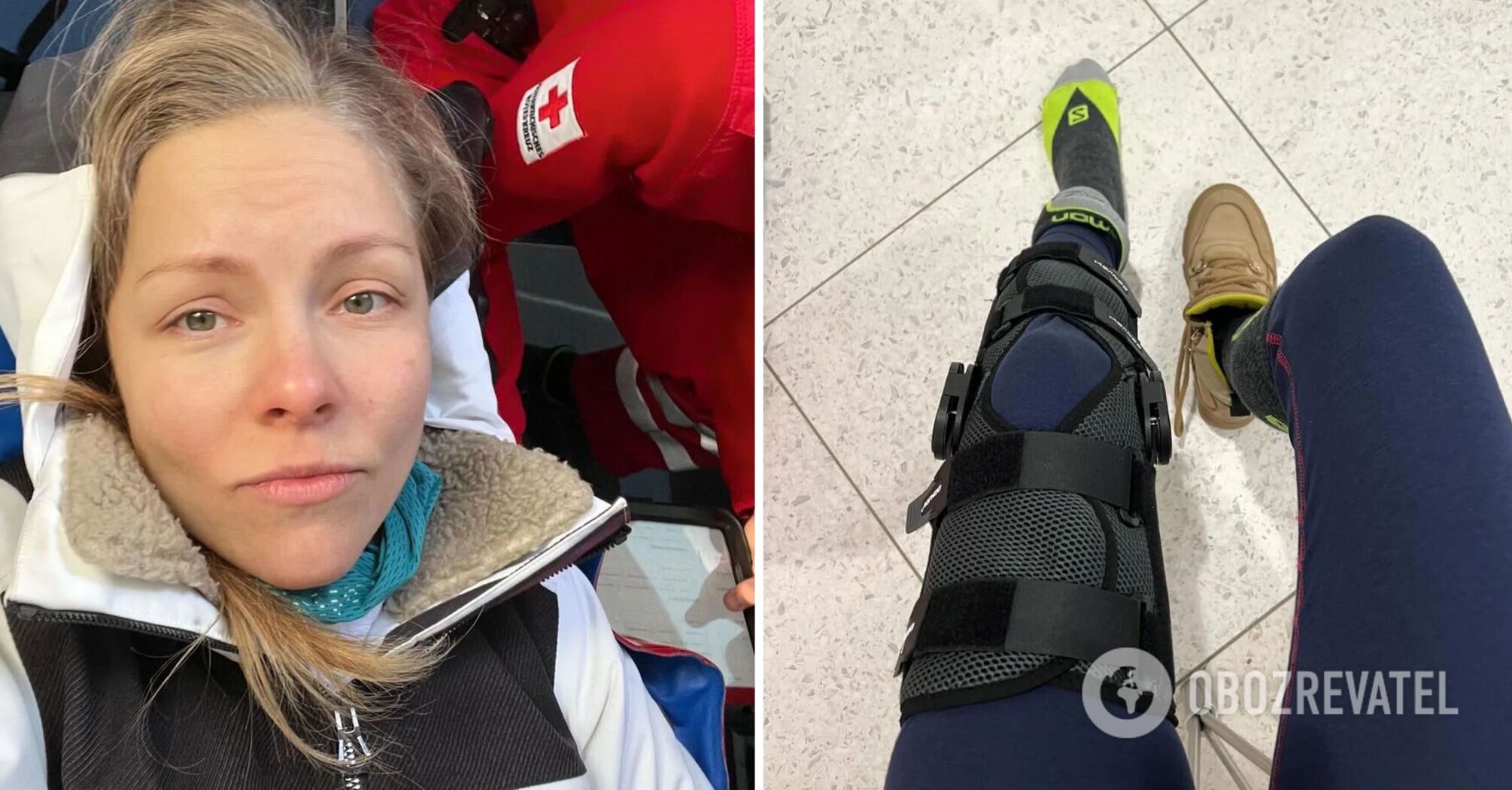 For the first time, Olena Shoptenko spoke about the accident that forced her to use crutches: I couldn't foresee it