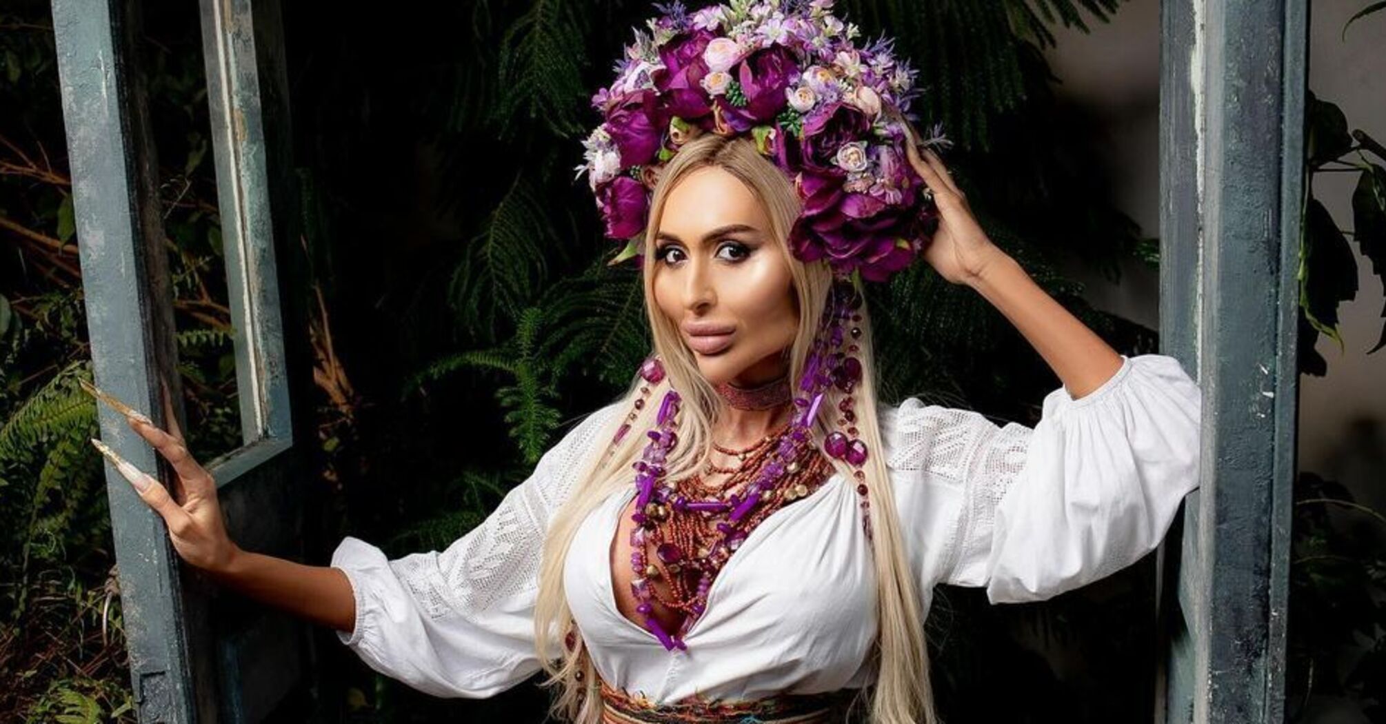 "I've never seen anything like this": Ukrainian woman with the world's largest cheekbones surprised with her X-ray
