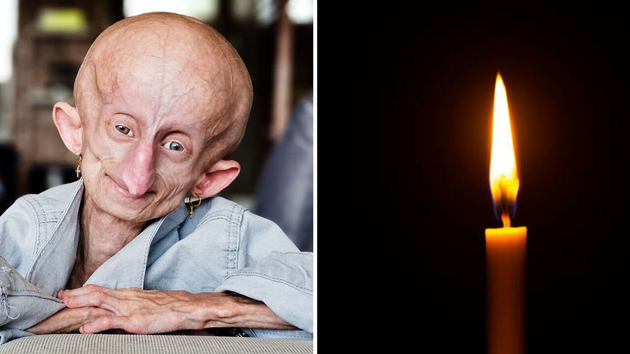 A unique blogger who aged eight times faster than normal has died: she was overcome by a rare incurable disease