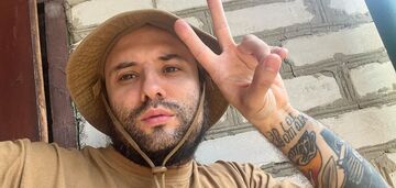 "League of Laughs" star and veteran Viktor Rozovyi showed how his scars healed after skull trepanation