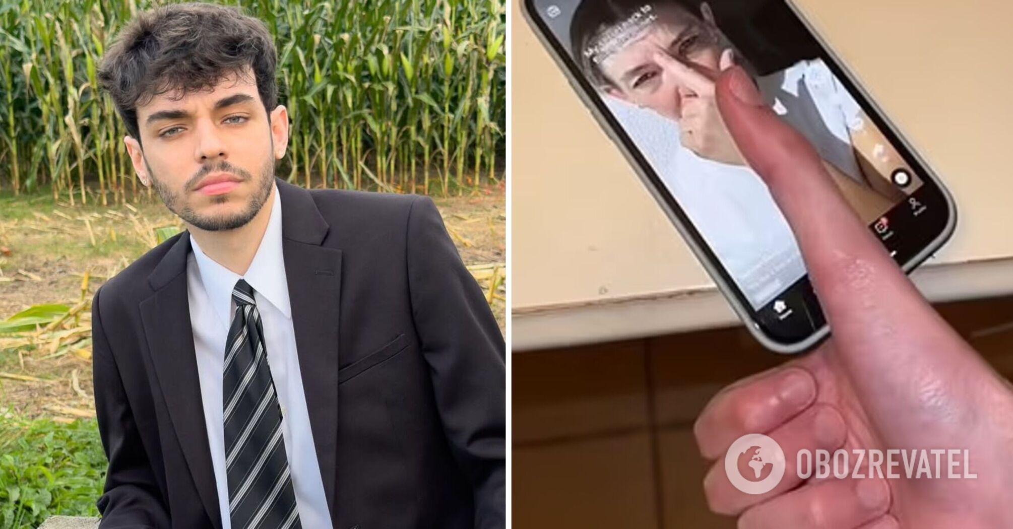 Man with world's largest thumb shows how the anomaly prevents him from using his phone. Video