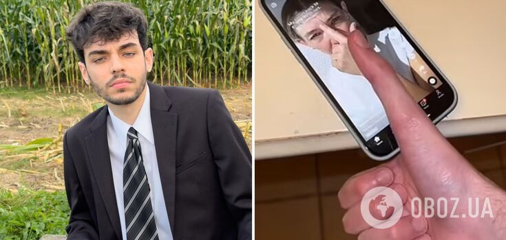 Mężczyzna z największym kciukiem na świecie pokazuje, jak anomalia uniemożliwia mu korzystanie z telefonu. Wideo