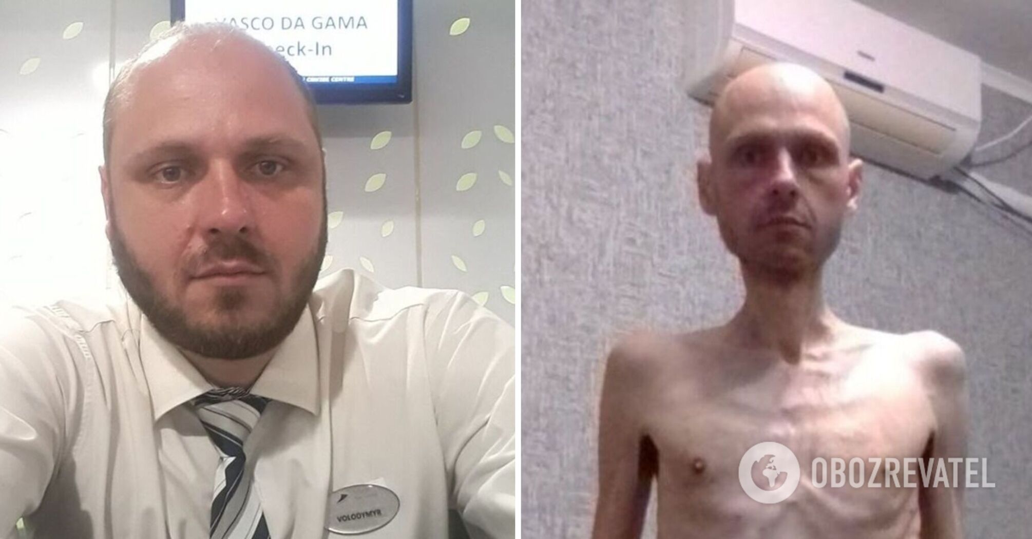 "I couldn't fully realize that I was free": Ukrainian soldier showed a terrible photo before and after Russian captivity