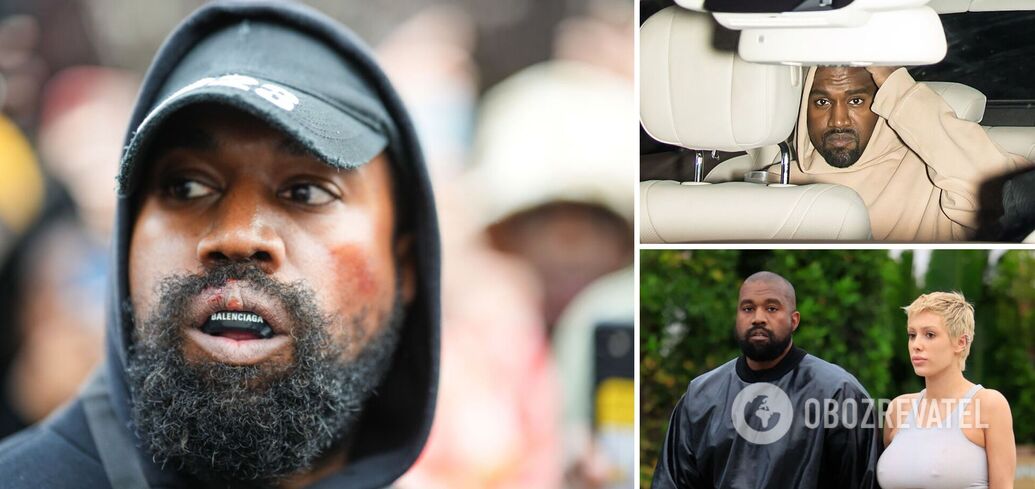 "O co chodzi z tymi ustami?" Kanye West, który stracił zęby za 850 000 dolarów, ponownie zaskoczył fanów