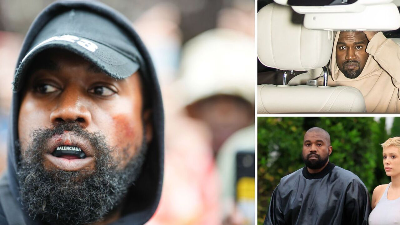 "What's wrong with your lips?": Kanye West, who got his teeth replaced for $850,000, has baffled fans once again