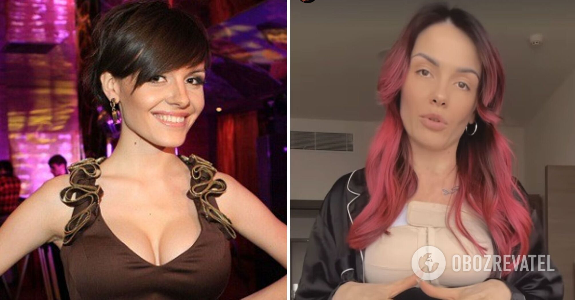 "I had a lush third size." MamaRika admits why she decided to have mammoplasty. Before and after photos