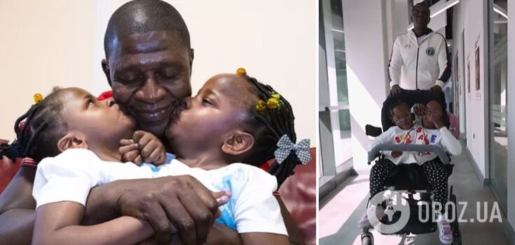 Inseparable sisters. What 7-year-old Siamese twins from Senegal look like now, having been given only a few days to live