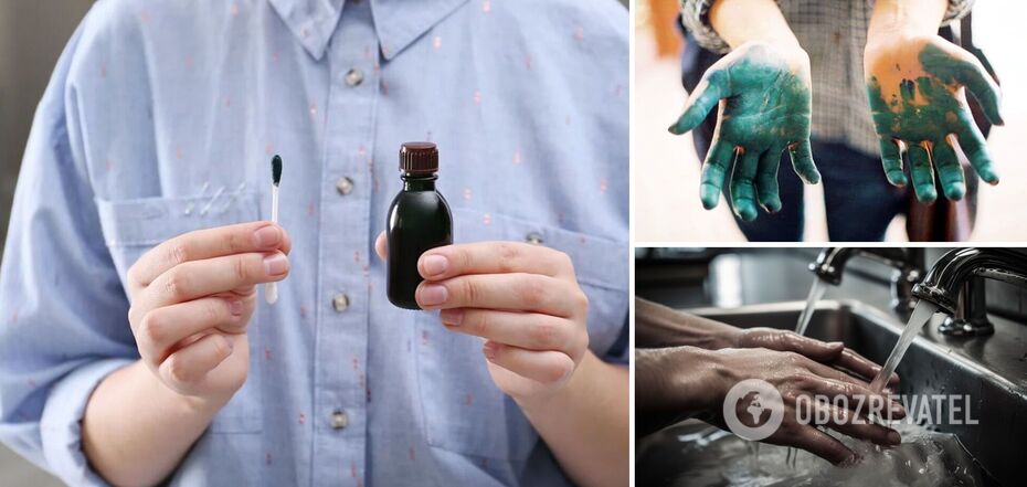 How to wash off brilliant green from skin and clothes: effective life hacks
