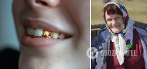 Why gold teeth were massively used in the USSR: where did the fashion come from