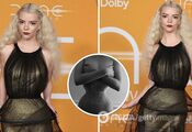 Anya Taylor-Joy was accused of promoting anorexia: why a photo of a half-naked actress in a corset outraged the network
