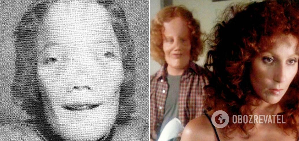 Face doubled in size: the real story behind 1985 movie The Mask, starring singer Cher