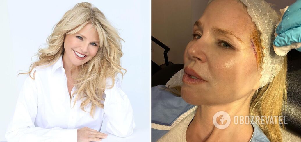 Christie Brinkley has been diagnosed with skin cancer: 70-year-old supermodel shows first photos after surgery