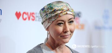 Shannen Doherty, who is battling stage four breast cancer, was frightened by a photo after removing a tumor from her brain