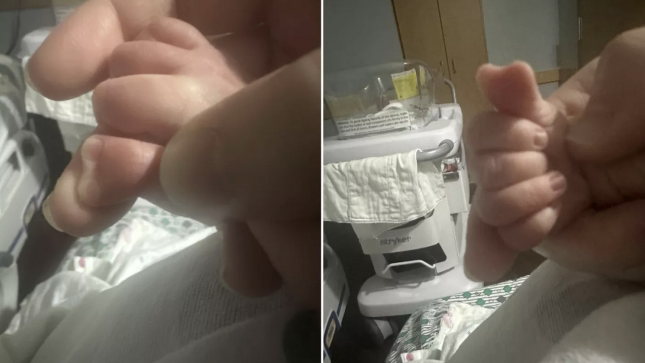 Doctors have never seen anything like it: a boy with a heart-shaped thumb was born in the United States. Photo
