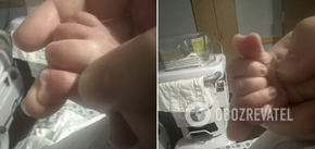 Lekarze nigdy czegoś takiego nie widzieli: w USA urodził się chłopiec z kciukiem w kształcie serca. Zdjęcie