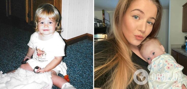 An American woman found out that she had Down syndrome only at the age of 23: what she looks like and what were the signs of the pathology