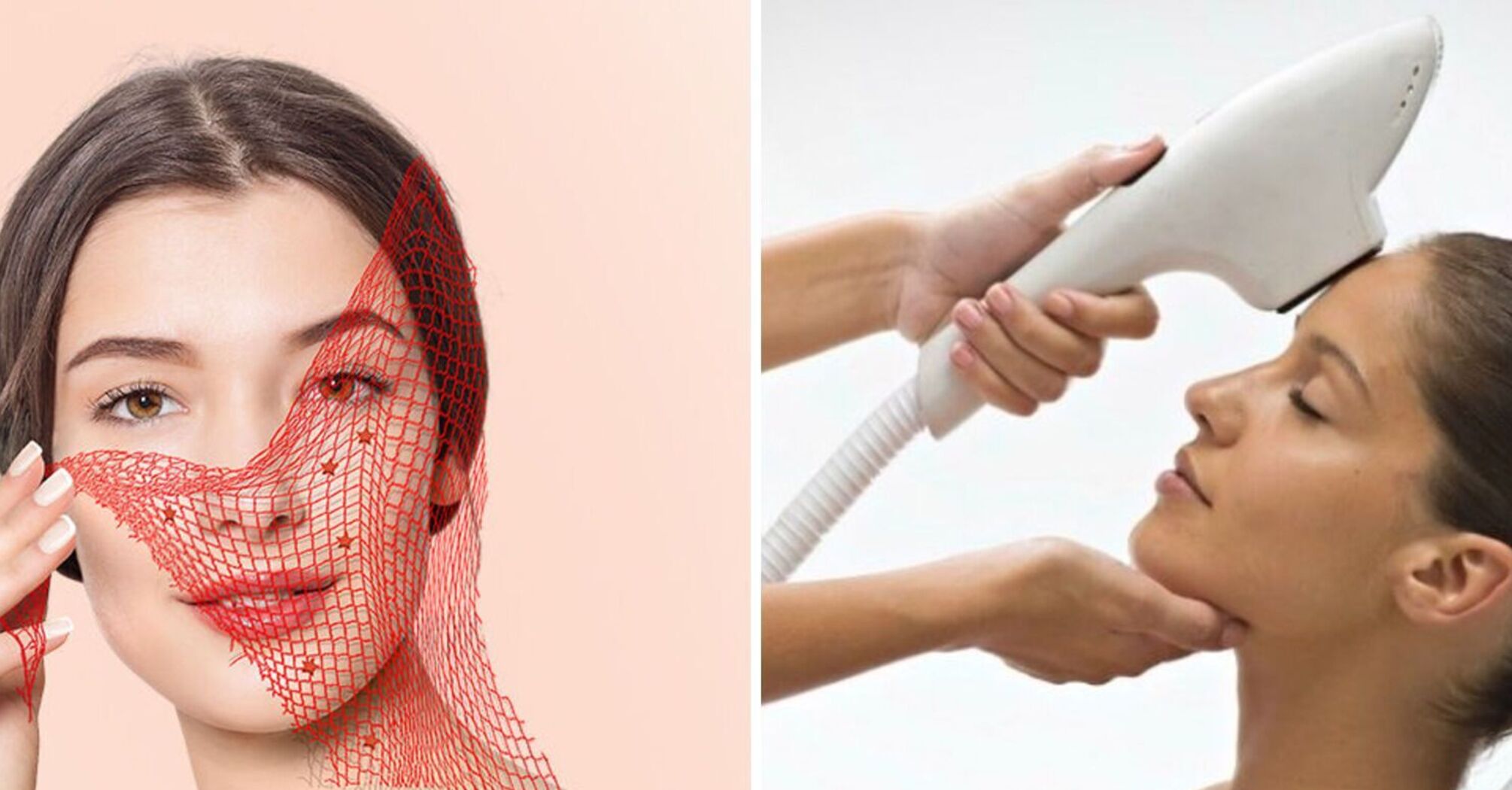 Чи можна назавжди позбутися розширених судин: найефективніші методи