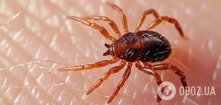 Tick season is in full swing: which places on the body are most favored by dangerous parasites
