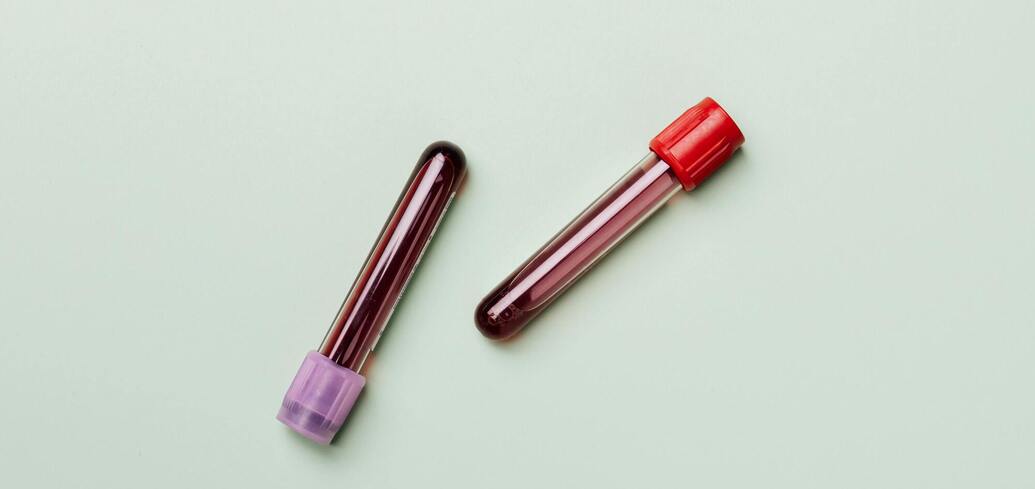 К чему снится кровь