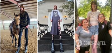 Nazywano ją 'humanoidem': jak wygląda 21-letnia kobieta z najdłuższymi nogami na świecie i dlaczego marzy o pozbyciu się tego 'tytułu'?
