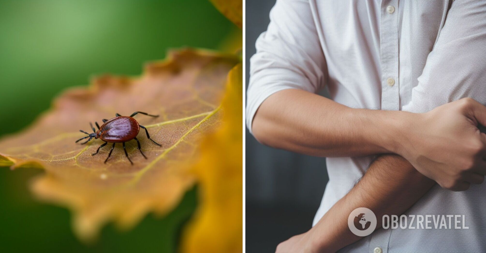 Nie można go po prostu wyciągnąć: immunolog mówi, jak prawidłowo usunąć kleszcza z ludzkiej skóry