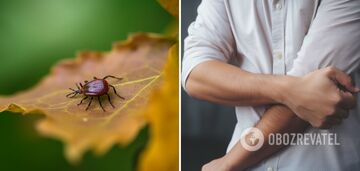You can not just pull it out: immunologist explains how to remove a tick properly