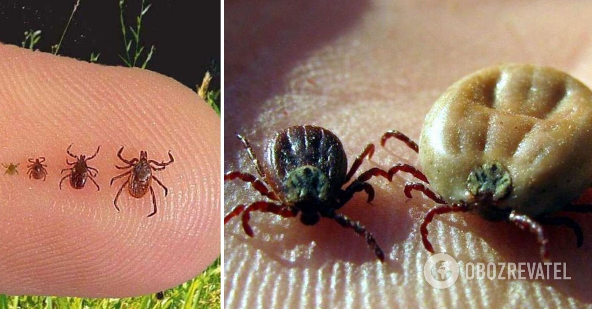 There are two main ways: an immunologist explains how to recognize a tick with a borreliosis pathogen