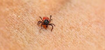 We must be guided by logic: an immunologist explains whether it is necessary to submit a tick found on yourself for testing
