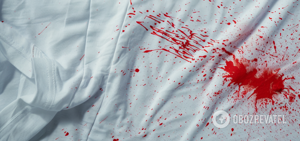 How to get rid of blood stains: unexpected ways
