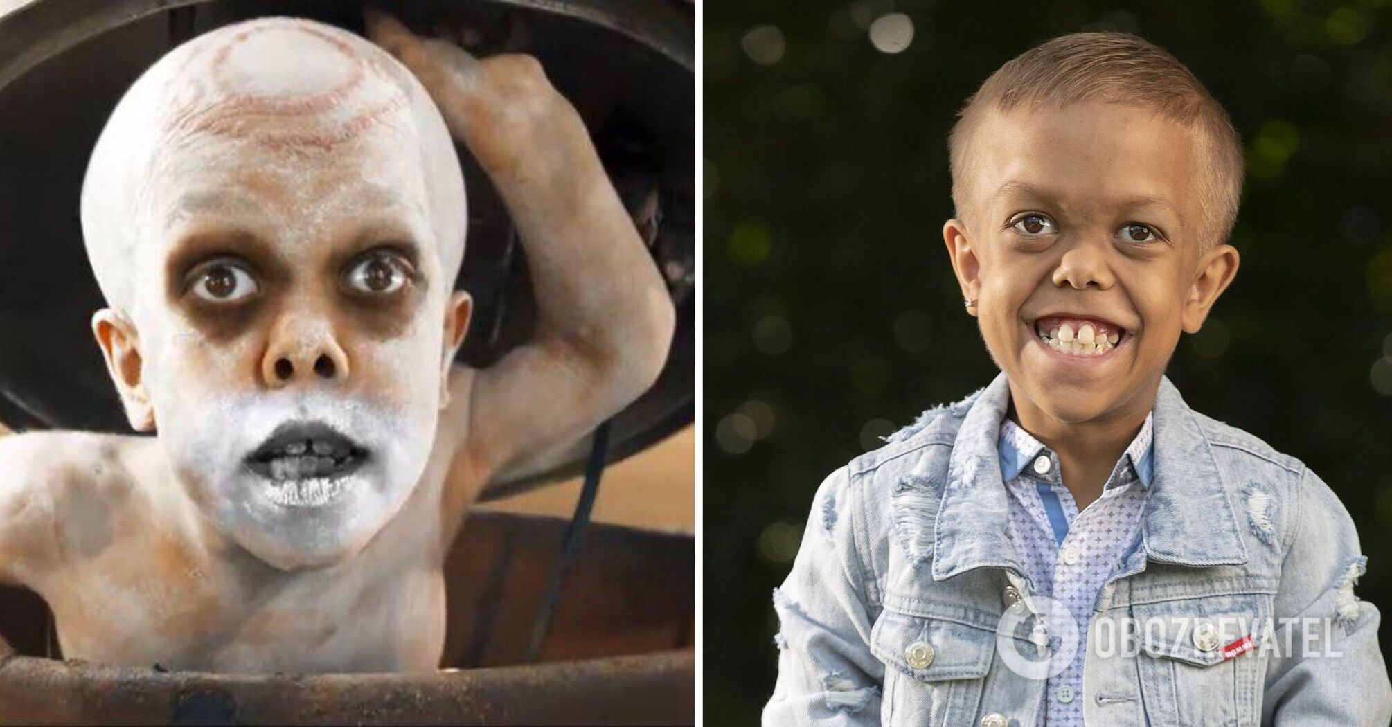 The director of "Mad Max" kept his word and filmed a boy who was bullied because of his dwarfism in "Furiosa". Trailer