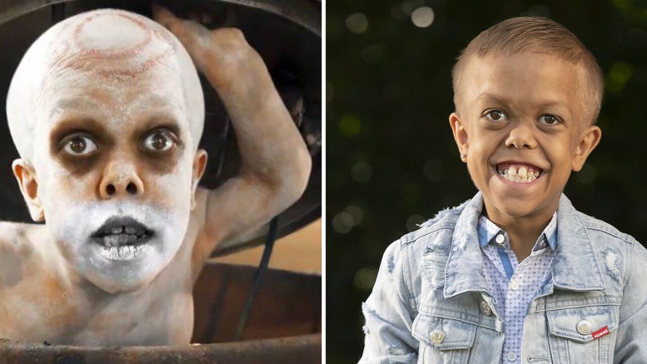 The director of "Mad Max" kept his word and filmed a boy who was bullied because of his dwarfism in "Furiosa". Trailer