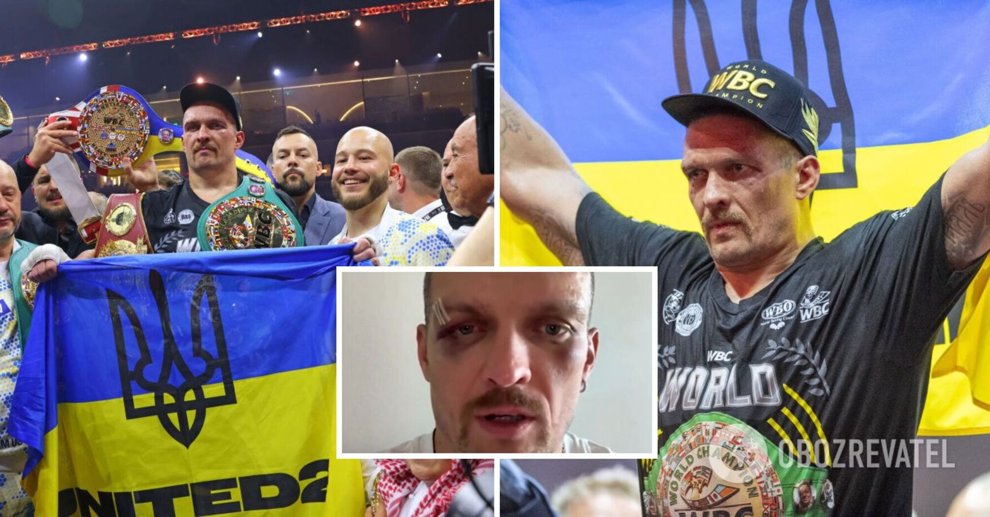 In haematomas and bruises: Usyk recorded an appeal to Ukrainians. Video