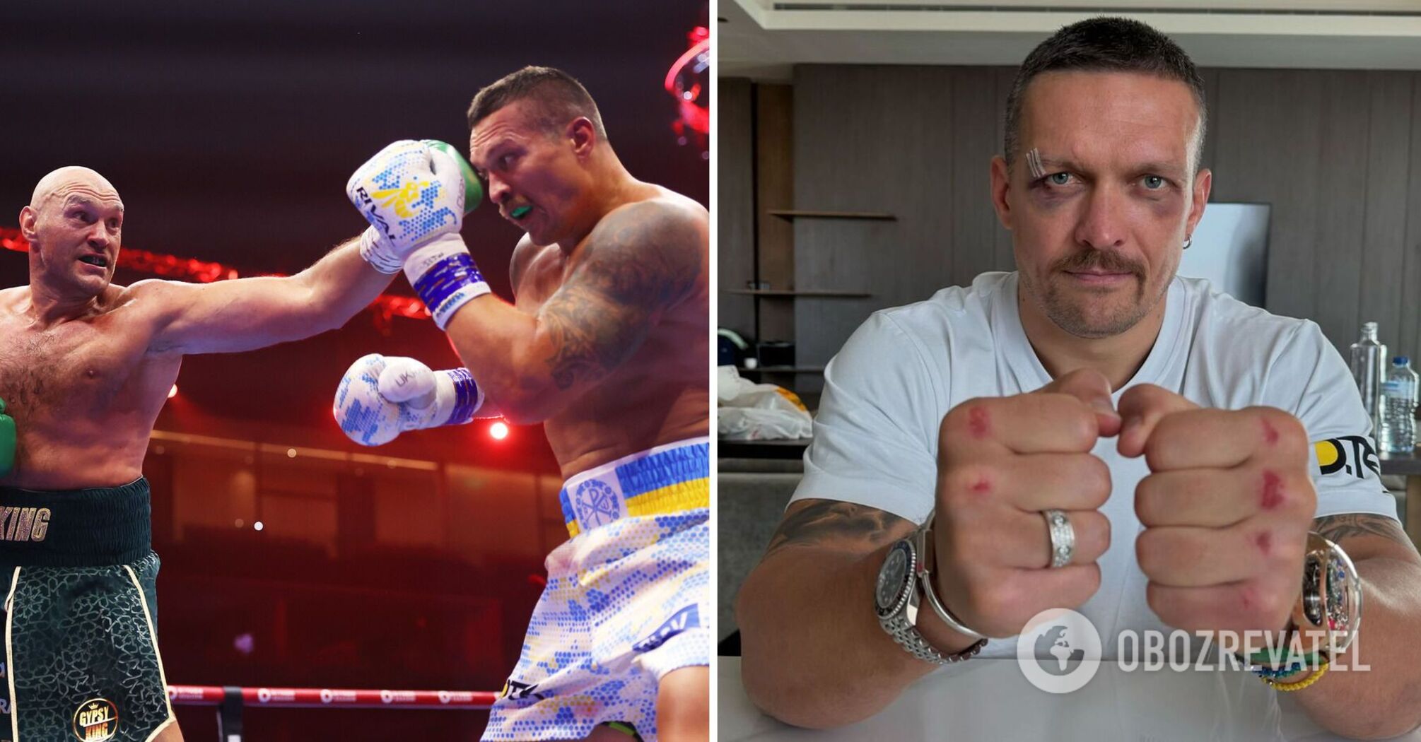Usyk showed how he looks three days after the fight with Fury. Photo
