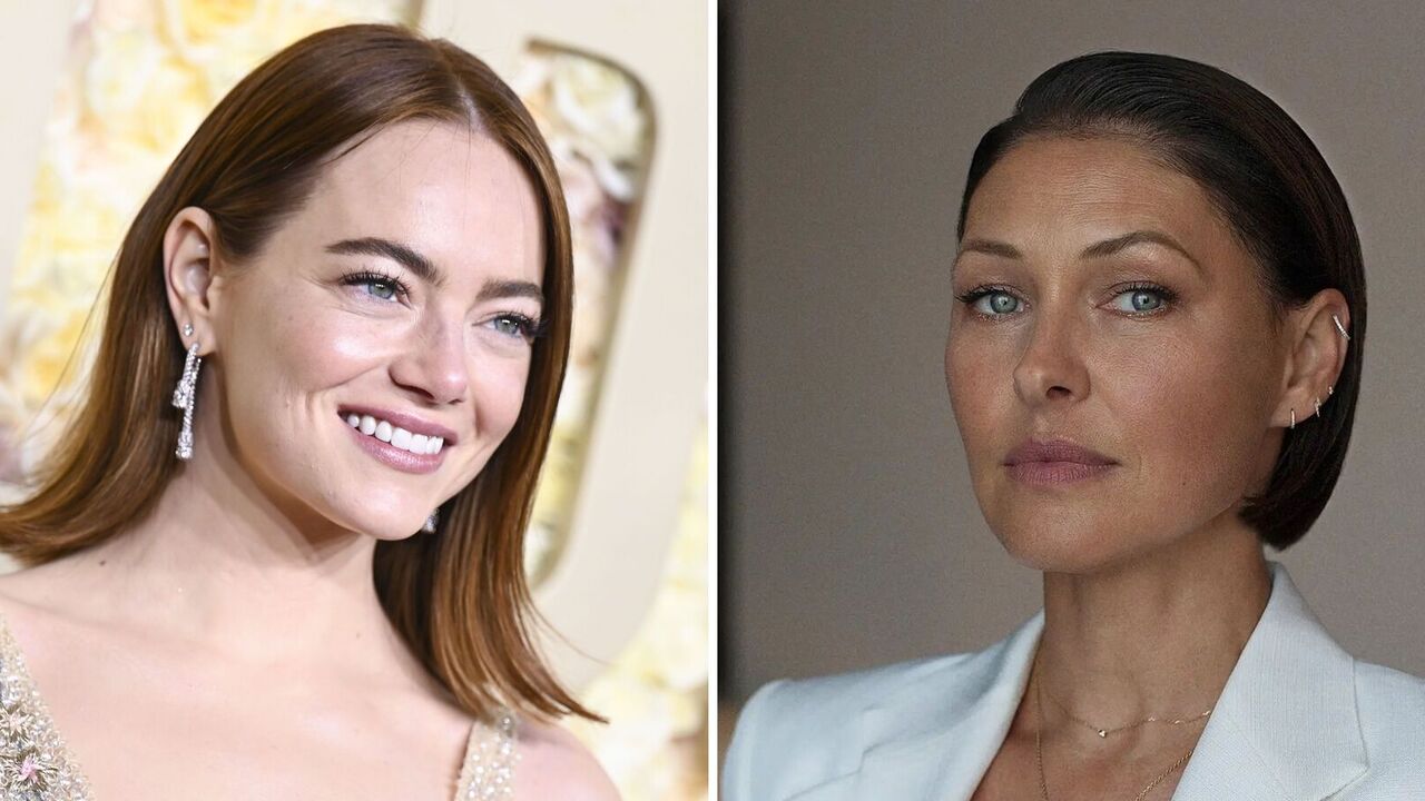 Fashion is dictated by the stars: 7 ideas for short haircuts for the summer that celebrities are already wearing. Photo