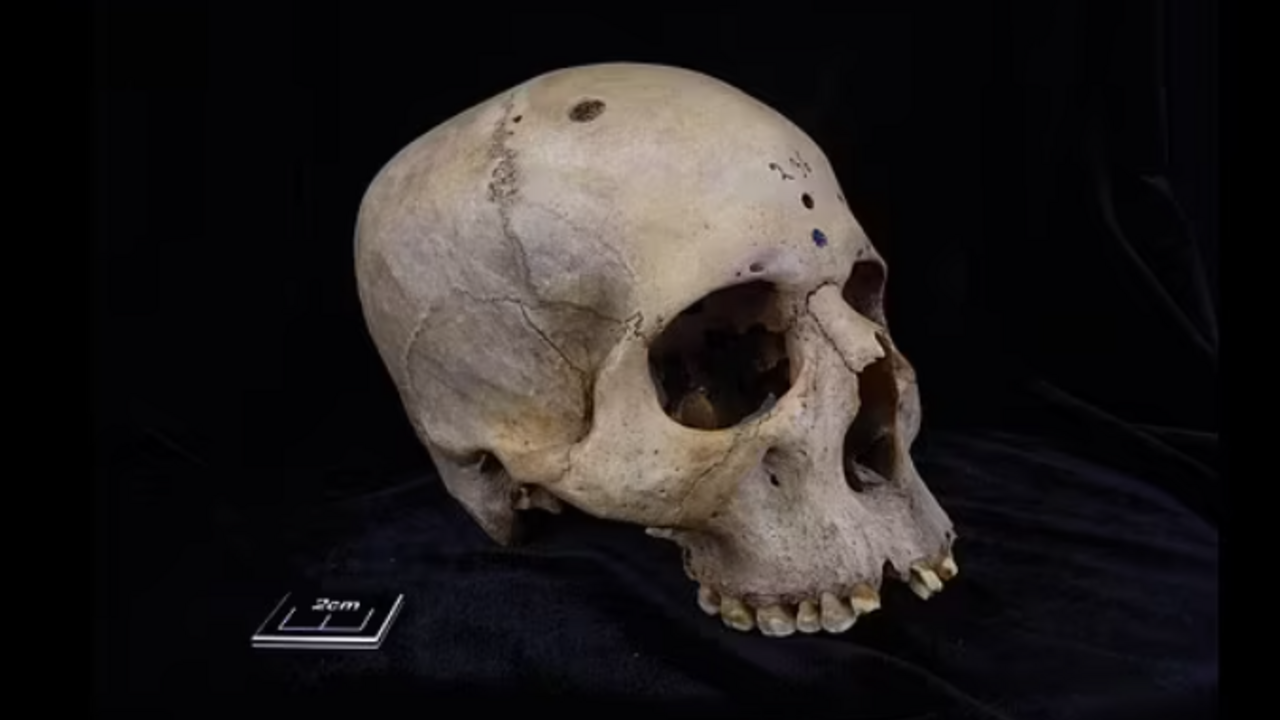 Ancient Egyptians tried to treat cancer: archaeologists examined a 4000-year-old skull and made a phenomenal discovery