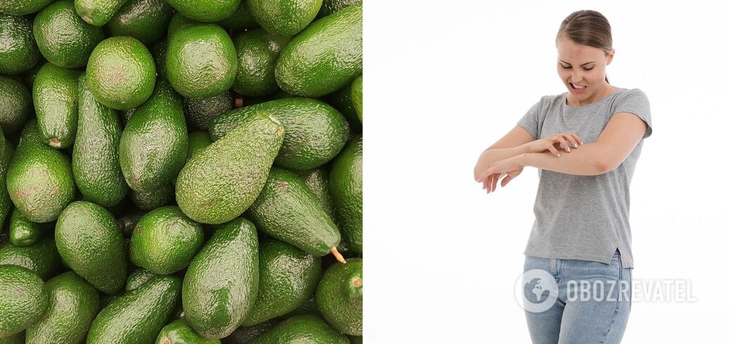 Allergic to avocado