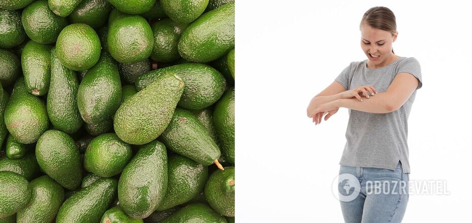 Allergic to avocado