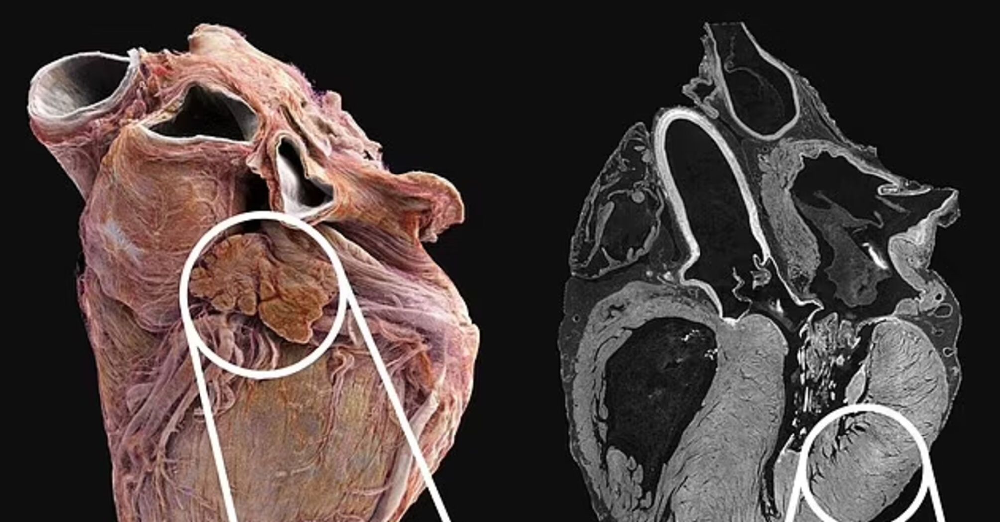 What the human heart looks like from the inside: scientists have shown the difference between a healthy and a sick organ. Impressive video
