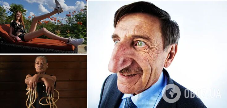 From the longest nose to the tallest family: top 9 amazing records of the human body that have not been broken yet