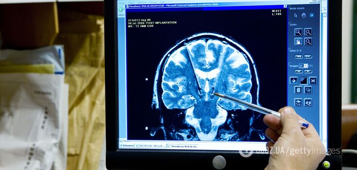 Scientists have inserted a "window" into a man's skull to look into his brain