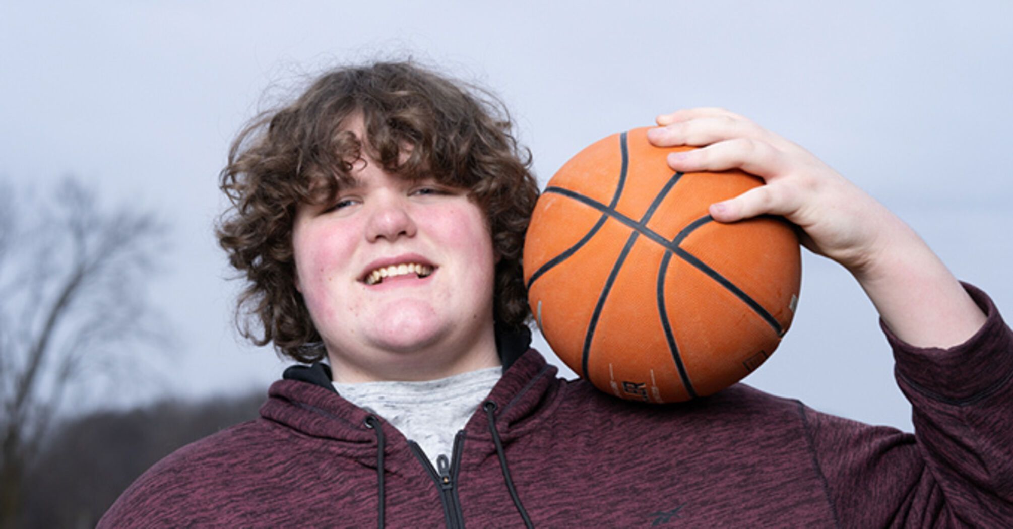 A 16-year-old teenager with giant feet and hands set two Guinness World Records at once. Photo.