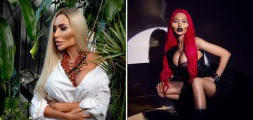More than 100 thousand dollars? The Ukrainian queen of plastic surgery told how much she spent on her operations and accused bloggers of lying