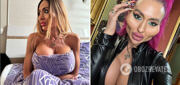"I wanted a bigger size". Ukrainian plastic surgery queen tells about three breast surgeries and a 6-hour surgery