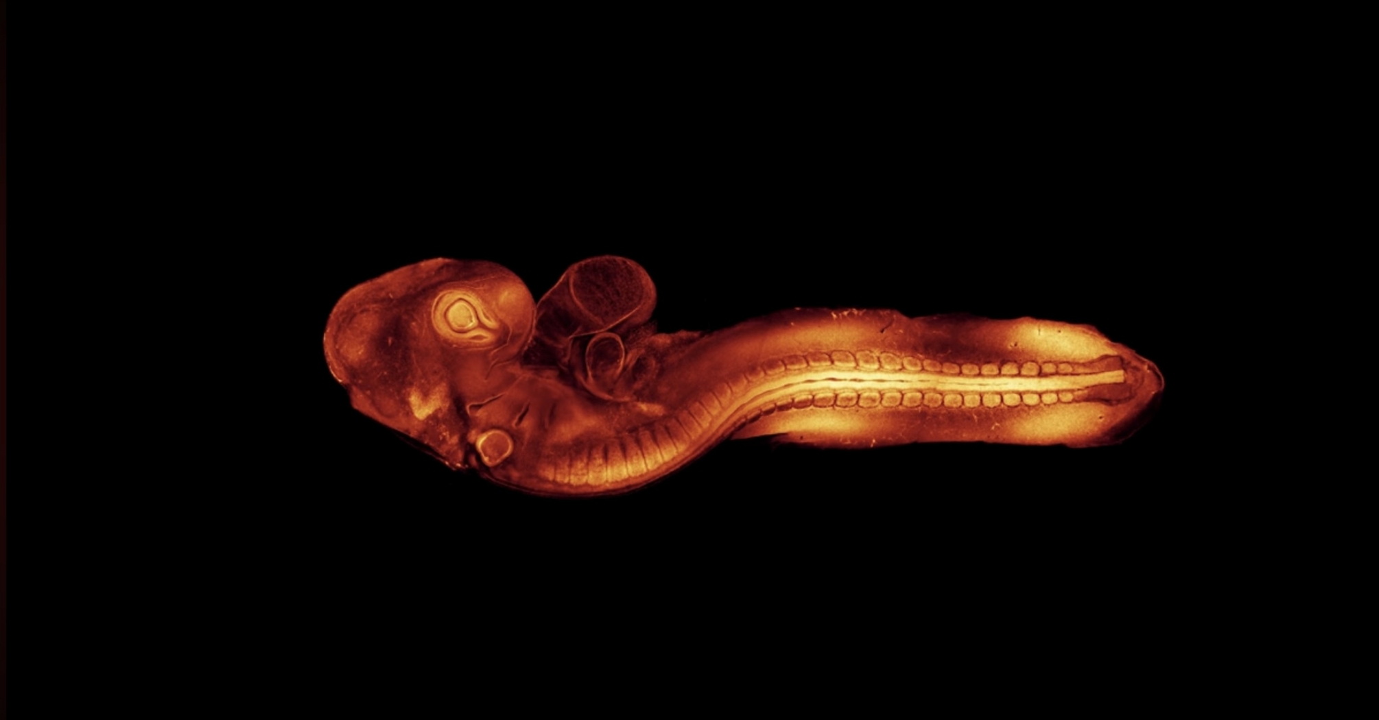 For the first time in history. Scientists have recorded a video of embryo formation at an early stage, which will help to detect birth defects