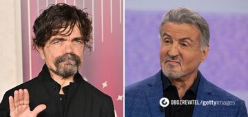 7 famous people with genetic mutations: cleft lip, two thumbs on one hand, and more. Photo