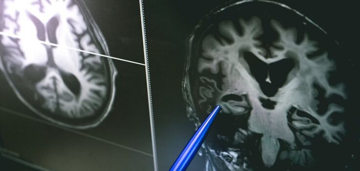 The brains just look different: new study shows why women are more emotional and have poorer spatial orientation