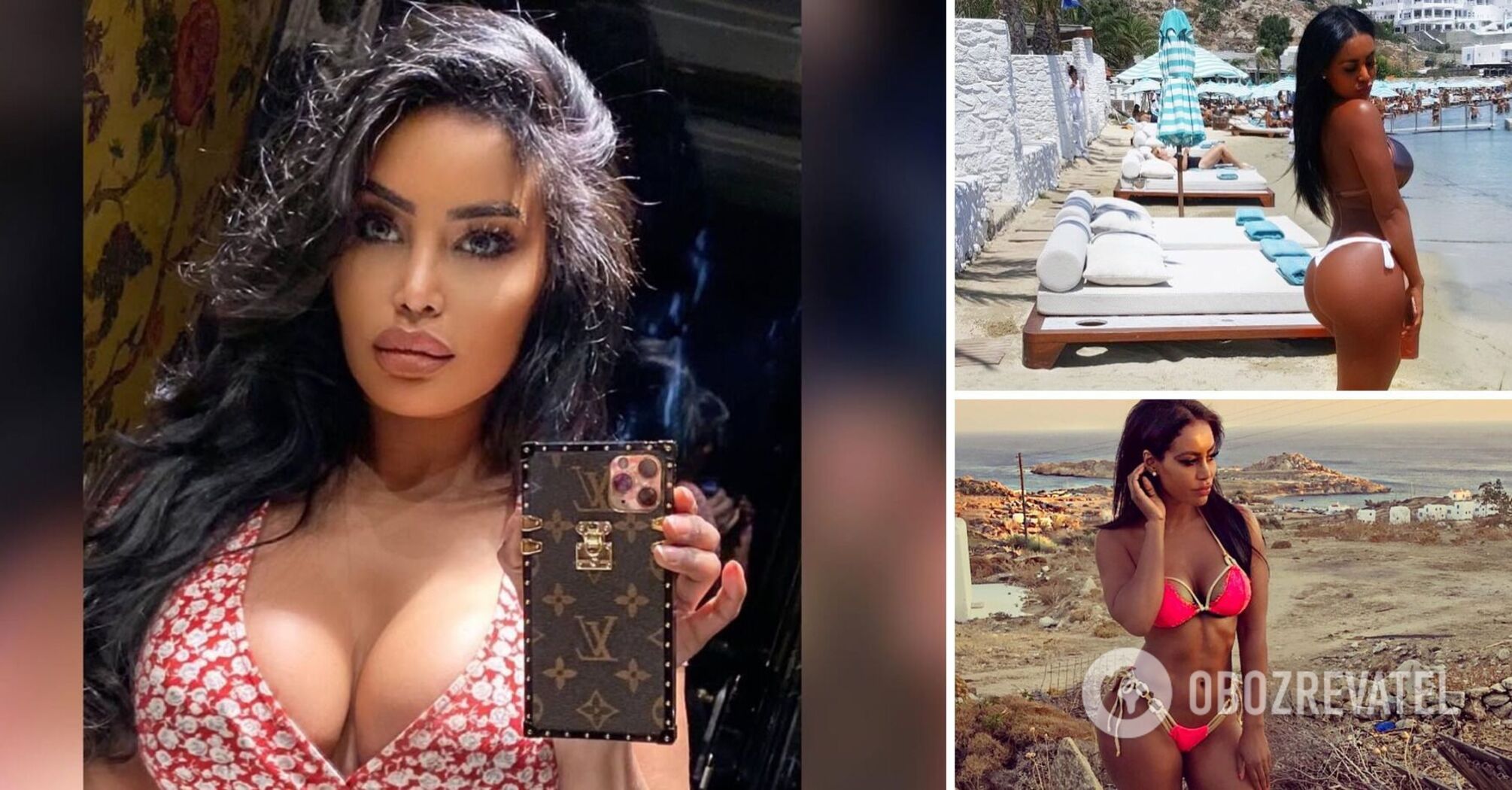 Playboy model who dated famous footballer dies from a butt lift